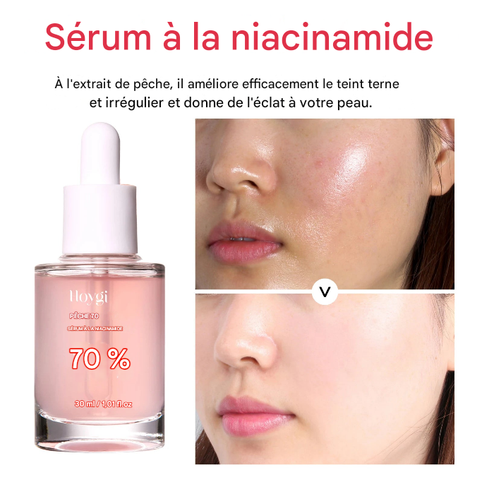 Sérum Niacinamide Anti-Taches - Éclat & Hydratation